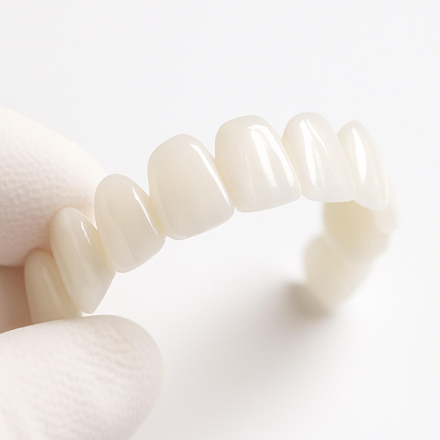 Porcelain Veneers